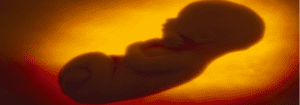 Senator Cruz pushes Passage of Pain-Capable Unborn Child Protection Act