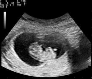 Texas Senators Examine Surrogacy Exploitation
