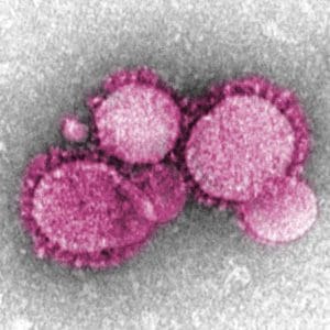 Commentary: Surrendering Freedom Is Not the Cure for Coronavirus