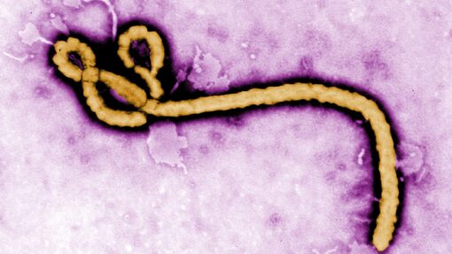 Concerns Arise in Houston Over Ebola and World Cup Travels